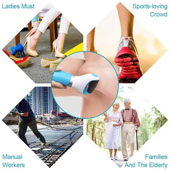 منتج إلكتروني للعناية بالقدم - Electronic Foot Care Product Foot File
